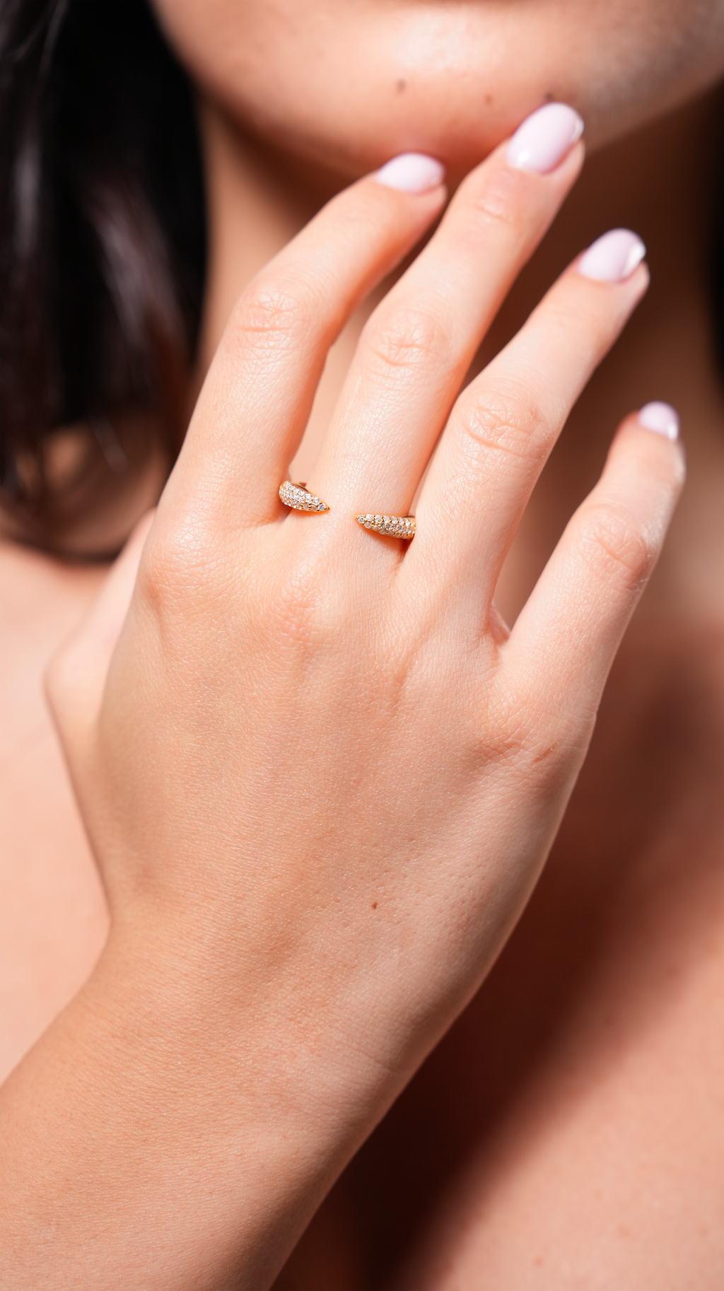 Milia Ring